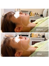 ウィズ ユー ビューティ(with U beauty)/印象変わりますね