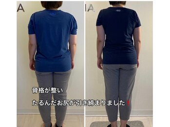 ナナ 吉祥寺店(NANA)/BeforeAfter