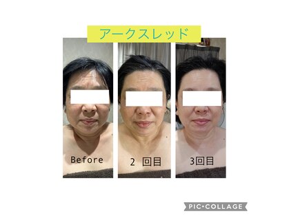 サロン ド スー(Salon de Suu)の写真
