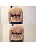 先着2名【2ヶ月集中痩身】フォースカッター通い放題モニター60分×12回