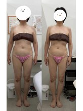 メリアミーゴ(Meli amigo)/60代　痩身ダイエット（お腹）