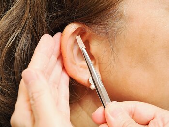 ヘルシースリム 大澤接骨院/耳ツボダイエット