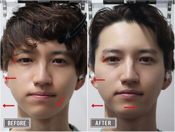 さつま骨格矯正 表参道青山院/歪み小顔矯正＋骨盤矯正