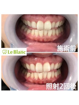 ルブラン 奈良店(Le Blanc)/都度払いでお越し頂いております