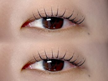 アイマジックピュア 一番町店(EYE MAJIC pure)/一重の方のアンドヘルシー施術例