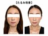 【むくみ・たるみ改善】お腹と脚からドバッと流す！全身循環小顔ケア★