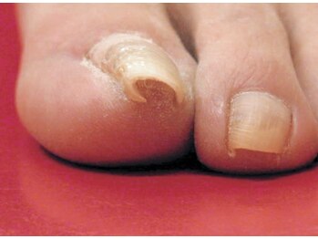 アイリーネイル(IRIE NAIL)/B/Sクイック