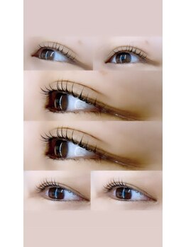 ビラ ベルダ(Bira Beldad)/