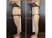 ダイエットならお任せください。