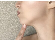 バーテックスキー(Vertexkey)/フェイスラインを綺麗にしたい