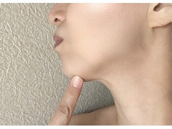 バーテックスキー(Vertexkey)/フェイスラインを綺麗にしたい