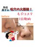 【毛穴の大掃除キャンペーン】角栓、黒ずみ、毛穴詰まりをオフしてスッキリ