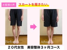よしみち整体院/オール美容整体でO脚が改善♪