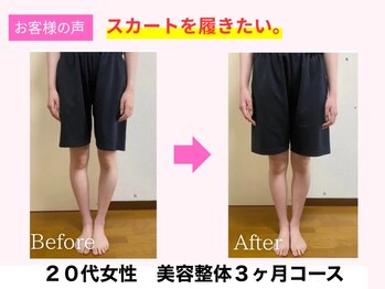 よしみち整体院/オール美容整体でO脚が改善♪