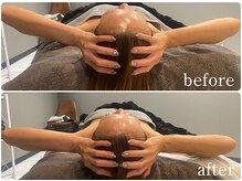 ルナリア ルクス 志木南口駅前店/NR機器を利用した施術