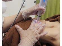 カーム(Calm)/プラズマシミケア