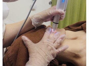 カーム(Calm)/プラズマシミケア