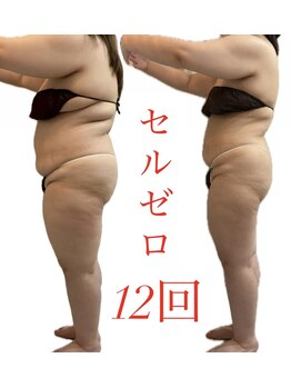 リノア(Lino'aka)/30代　○○さんの変化　痩ボディ