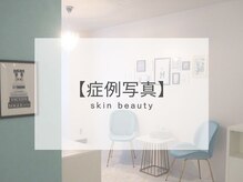 リフト センター南(Lift)/小顔専門店Lift