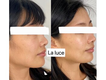 ラルーチェ(La luce)/エクスビアンス