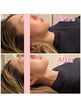 クオコア(KUOKOA)/Before/After