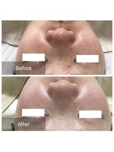 ダリア(Dahlia)/繰り返す肌荒れにお悩みの方