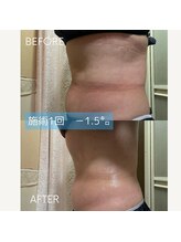 ヴィオテラス(VIOTERACE)/★上半身ダイエット★