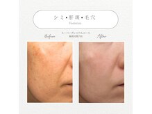 メゾンドフォレスト(Maison de Forest)の雰囲気（小顔・Vライン・美白・脂肪・シミケア・ブライダル・痩身）