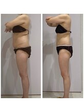 キュール(KuhL)/痩身ビフォーアフター☆