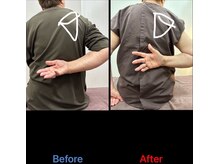 ラムーン(La.Moon)/肩の痛み施術