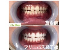 ルブラン 奈良店(Le Blanc)/圧倒的フリーパスコース！！