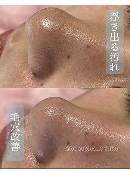 ビジュープラス ひたち野うしく店(Bijou+)/