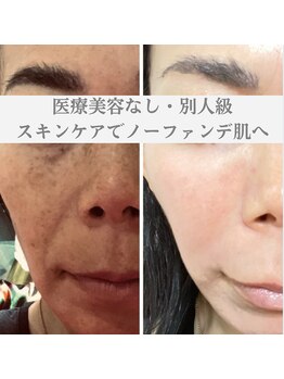 デアマリス/お顔の印象はシミ・シワ・たるみ