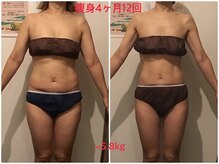 ビープロデュース 亀有店(BPRODUCE)/Before &after