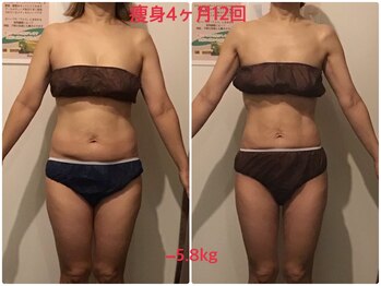 ビープロデュース 亀有店(BPRODUCE)/Before &after