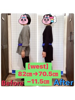 ヒデ整体院(Hide整体院)/ダイエット痩身成果＆骨盤矯正