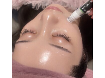 ユアンスボーテ(Yuence Beaute)の写真