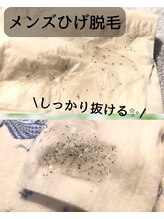 ゲッカ(GEKKA)/メンズひげ脱毛