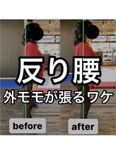 カワル整体 上通り院/反り腰で外腿が張る理由