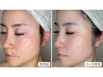 トパーズ 掛川店(Topaz)/リアボーテ クレアスキン使用