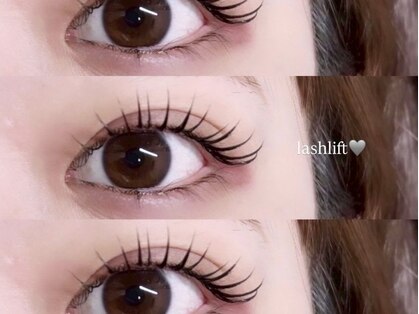 フィールリファイン(Feel Refine)の写真