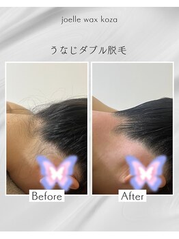ジョエルワックス 沖縄コザ店(JOELLE WAX)/うなじダブル脱毛☆