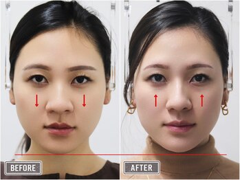 さつま骨格矯正 表参道青山院/歪み小顔矯正＋骨盤矯正