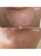 シェノン 赤坂大濠店/