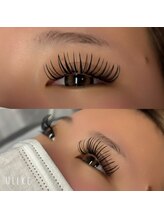 ブリンク/バインドロック140束！