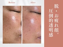 トリートメントサロンビューティープラス(Treatment Salon Beauty+)/