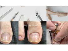 シーディーエム(cdm)の雰囲気（ 巻き爪を優しく整え快適な足元へ☆）