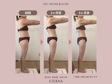 エテルナ(Eterna)