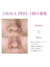 ベル(BELL)/毛穴の黒ずみもスッキリ