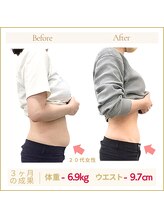 アロハ(ALOHA.)/お腹の浮き輪肉がスッキリ！